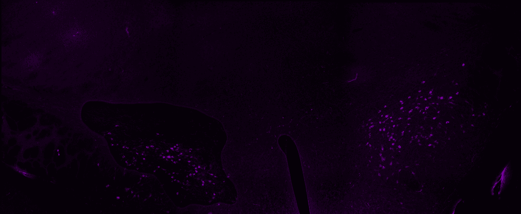 Immunoflourescent image of neurons that respond to the neuropeptide orexin (magenta against a black background.