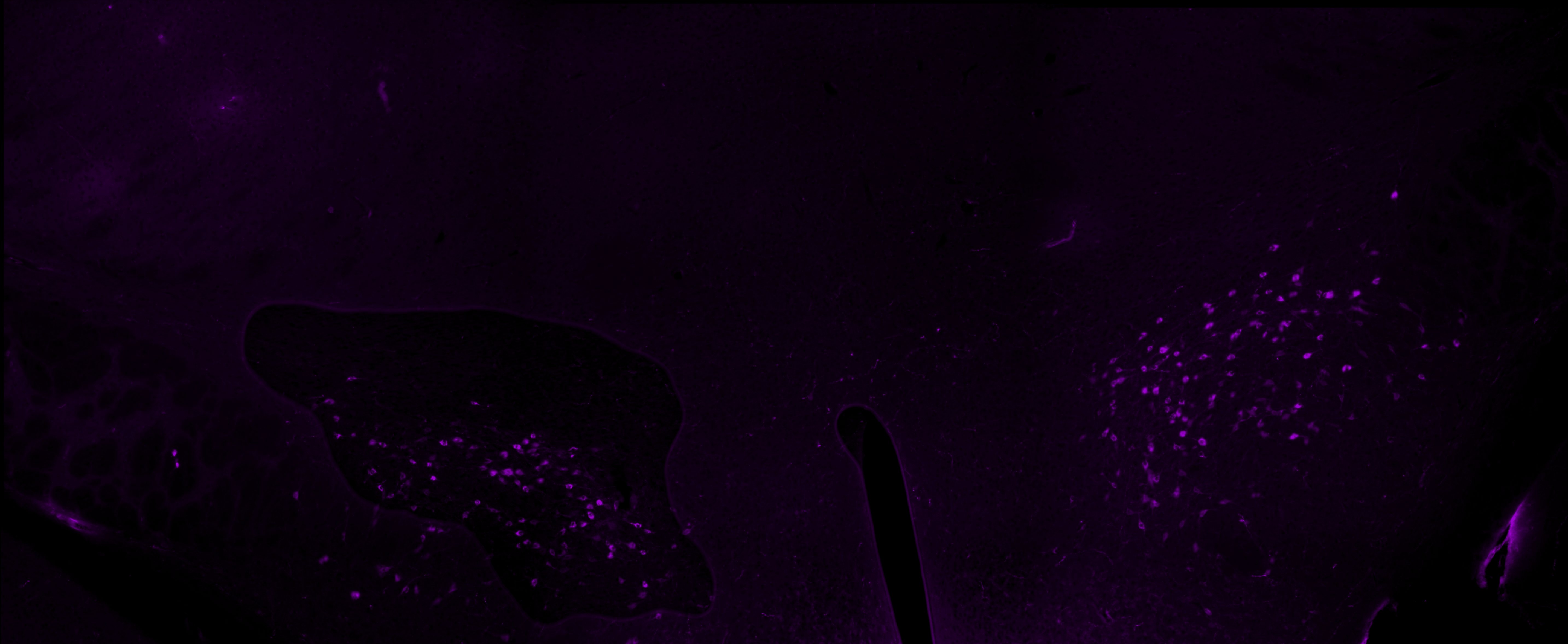 Imagem imunoflorescente de neurônios que respondem à orexina neuropeptídica (magenta contra um fundo preto. Imagem imunoflorescente de neurônios que respondem à orexina neuropeptídica (magenta contra um fundo preto.