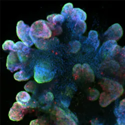 Fluorescence microscopy image of a human small intestine organoid stained with Ki67 and EpCAM antibodies and DAPI (scale bar represents 100 micrometers). 
