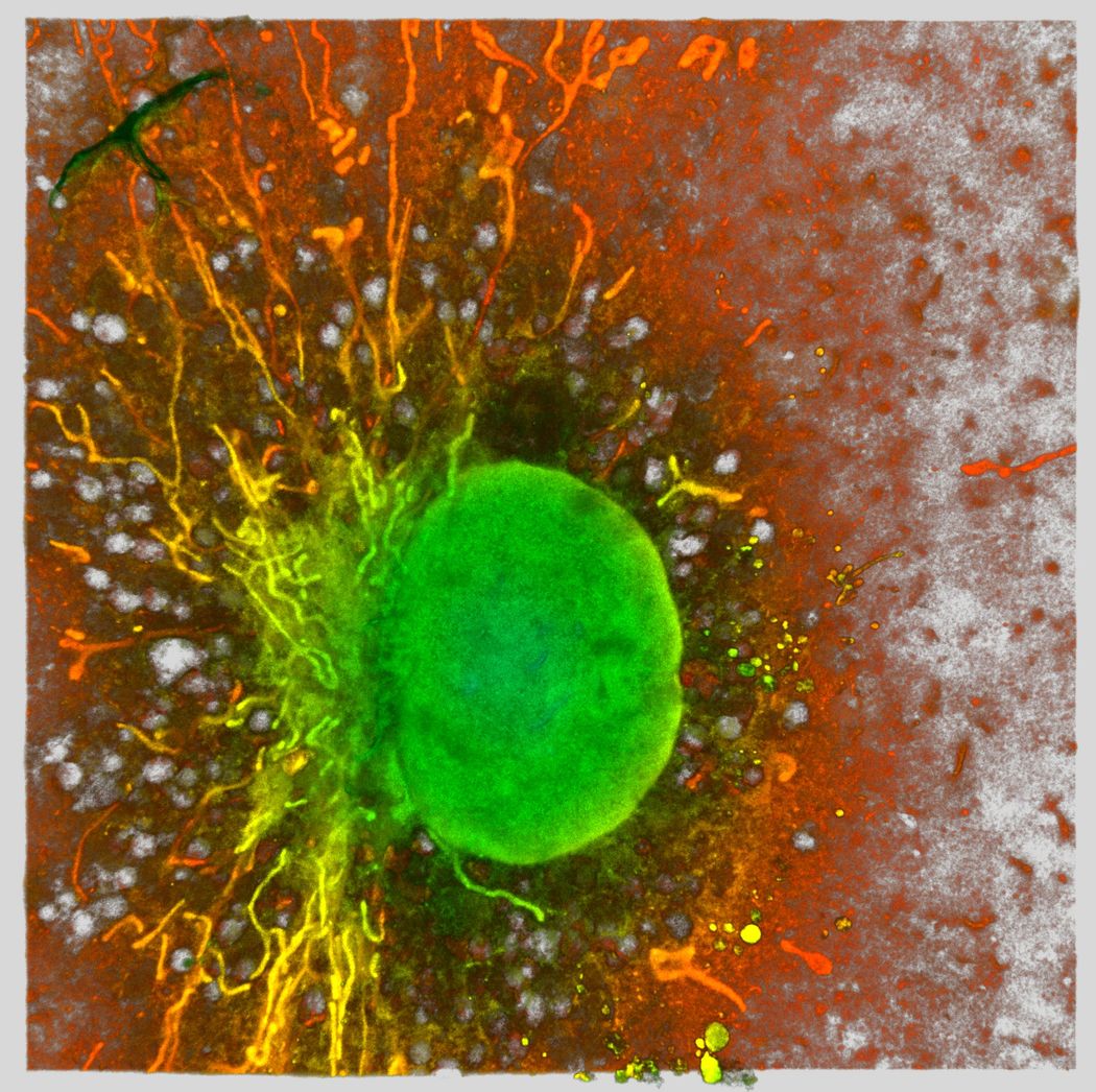 A green-colored sphere surrounded by thin, yellow and orange structures against an orange background. A green-colored sphere surrounded by thin, yellow and orange structures against an orange background.