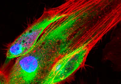 Red, green, and blue fluorescently labeled skin cells on a black background.
