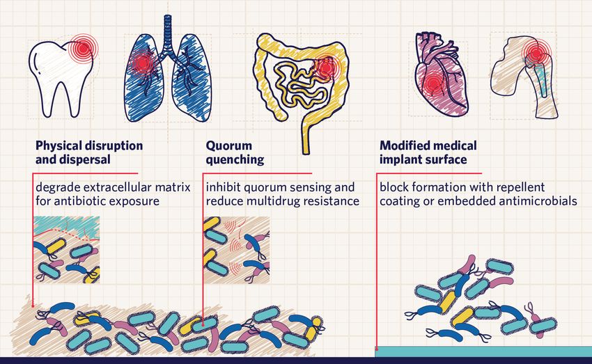 Infographic depicting surfaces where biofilms commonly grow (teeth, lungs, intestines, heart valves and devices, and medical implants), and strategies to combat them (physical disruption and dispersal, quorum quenching, and modified medical implant surfaces). Infographic depicting surfaces where biofilms commonly grow (teeth, lungs, intestines, heart valves and devices, and medical implants), and strategies to combat them (physical disruption and dispersal, quorum quenching, and modified medical implant surfaces).