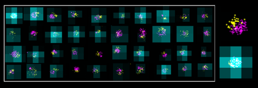 A microscopy image showing an LNP sample stained using the LNP Profiler Kit. The sample was imaged with the AutoLNP workflow on the Nanoimager and analyzed using CODI. PanLNP (magenta) marks the overall size of each nanoparticle, the ligand channel (yellow) indicates surface engineering, and the diffraction-limited RNA stain (cyan) reveals mRNA encapsulation. The LNP in the top right appears empty, lacking RNA signal, while the LNP in the bottom right is loaded, showing clear mRNA encapsulation. A microscopy image showing an LNP sample stained using the LNP Profiler Kit. The sample was imaged with the AutoLNP workflow on the Nanoimager and analyzed using CODI. PanLNP (magenta) marks the overall size of each nanoparticle, the ligand channel (yellow) indicates surface engineering, and the diffraction-limited RNA stain (cyan) reveals mRNA encapsulation. The LNP in the top right appears empty, lacking RNA signal, while the LNP in the bottom right is loaded, showing clear mRNA encapsulation.