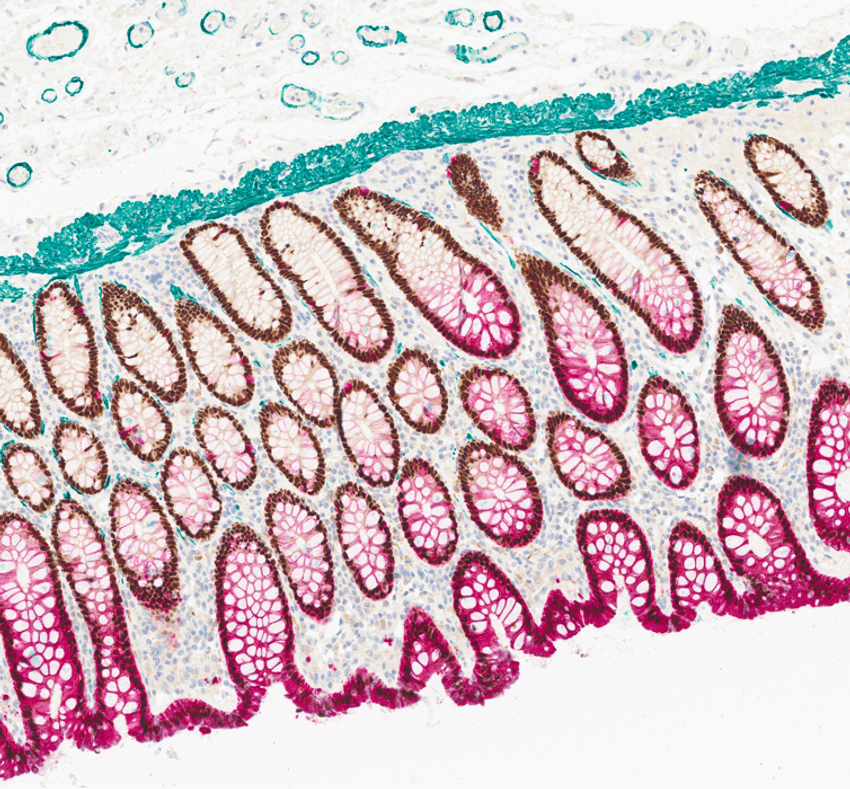 ChromoPlex III stain of a tissue section that shows the spatial localization of 3 proteins with unique color signals