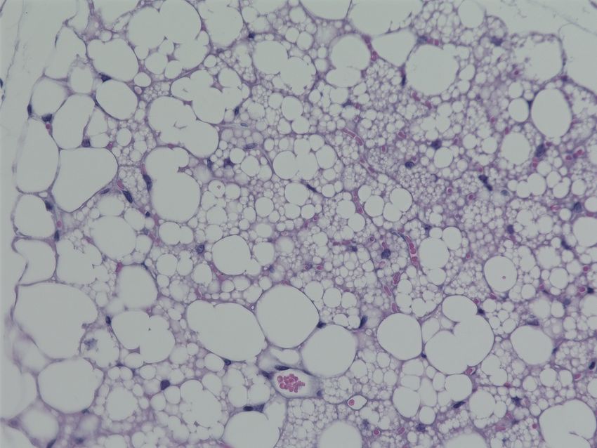 A microscopy image of white, rounded cells with purple borders. A microscopy image of white, rounded cells with purple borders.