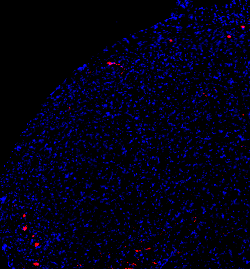 Mouse medullary dorsal horn projection neurons (in red).