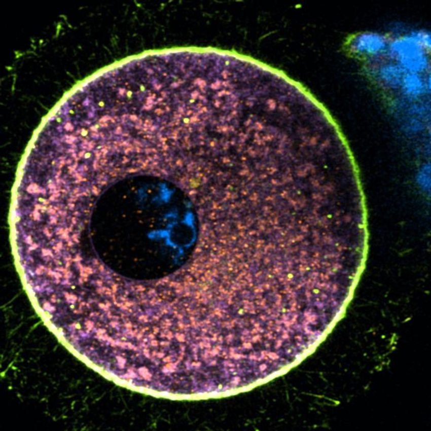 A microscopic image of an immature human oocyte showing the localization of diverse intracellular organelles.