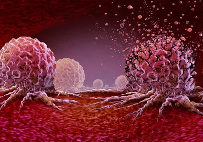 Cancerous growths in pink are shown on a red surface. Cancerous growths in pink are shown on a red surface.
