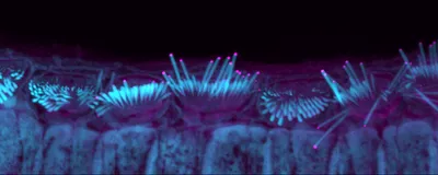 A fluorescence image of stereocilia of inner ear cells is shown with the stereocilia labeled in blue and the Eps8 protein at the tips of stereocilia shown in pink.