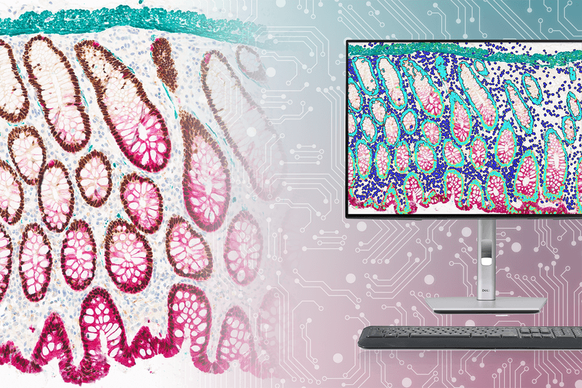 ChromoPlex III Triple Detection RUO