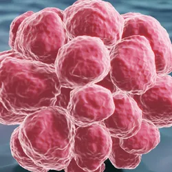 3D illustration of pink cancer cells on a blue background. 3D illustration of pink cancer cells on a blue background.