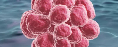 3D illustration of pink cancer cells on a blue background.