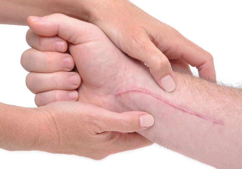 Why Some Wounds Don’t Leave Scars