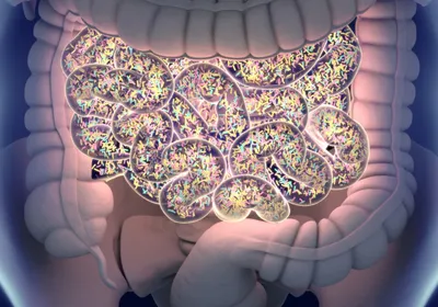 3D illustration of a transparent human abdomen with the large and small intestine visible. The small intestine appears to have a light emanating from within it and is full of yellow, blue, and pink microbes. This image is highlighting the role of the gut microbiome in chronic pain. 3D illustration of a transparent human abdomen with the large and small intestine visible. The small intestine appears to have a light emanating from within it and is full of yellow, blue, and pink microbes. This image is highlighting the role of the gut microbiome in chronic pain.