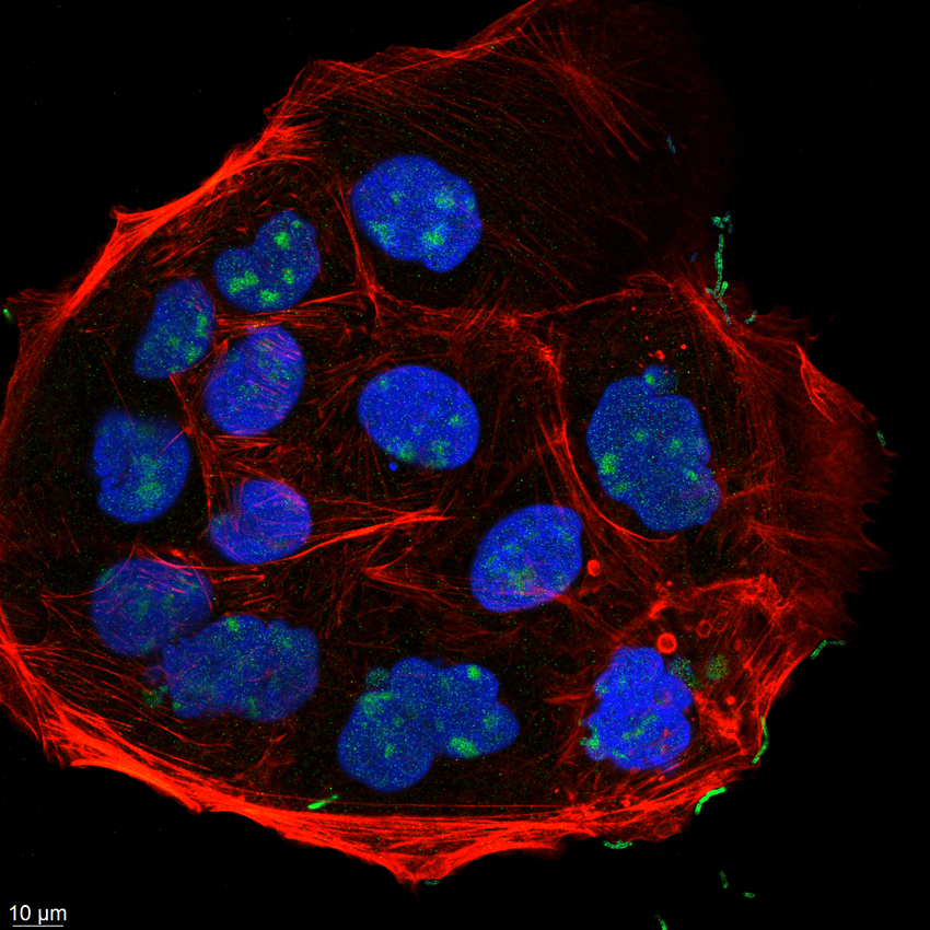 A microscopy image of human epithelial cells with round blue nuclei surrounded by bundles of red actin against a black background. Green spots, denoting the bacterium E. ramosum can be seen in some places.