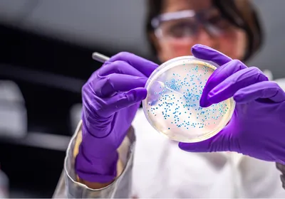 A scientist in a microbiology laboratory working with an Agar plate that has a few blue colonies.