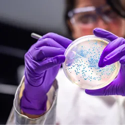 A scientist in a microbiology laboratory working with an Agar plate that has a few blue colonies.