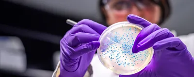 A scientist in a microbiology laboratory working with an Agar plate that has a few blue colonies.