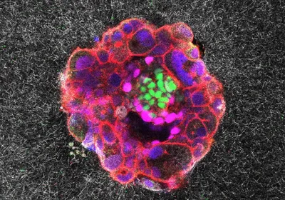 Microscopy image of a multicolored (green, magenta, blue, and green) spherical human embryo implanted on the synthetic matrix (the grainy grey-black background).