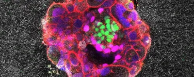 Microscopy image of a multicolored (green, magenta, blue, and green) spherical human embryo implanted on the synthetic matrix (the grainy grey-black background). 