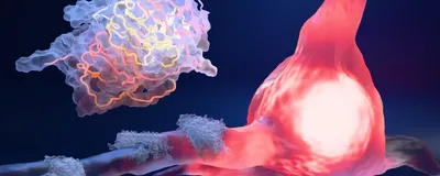 3D illustration of a neuron with the cell body highlighted in pink to represent damage from an amyloid β plaque on its axons to the left. An enlarged plaque bundle is shown in the top left corner of the image, with the fibrils highlighted in pink and yellow. 