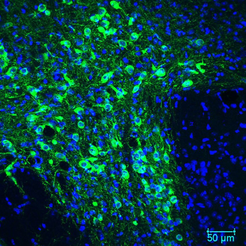 Cell bodies of dopamine neurons are stained green.