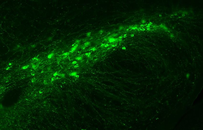 Dopamine neurons are stained green; their role in movement disorders suggests that people shouldn’t try to deplete their dopamine or dopamine detox using non-behavioral strategies.