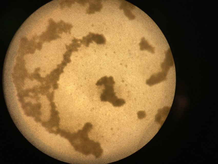 Microscopy image showing tonsil organoids, which appear like a few brownish-looking clumps of cells. Microscopy image showing tonsil organoids, which appear like a few brownish-looking clumps of cells.