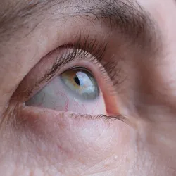 Photograph of an up-close shot of a person’s face to focus on their eye, which is looking upward. 