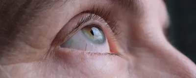 Photograph of an up-close shot of a person’s face to focus on their eye, which is looking upward. 