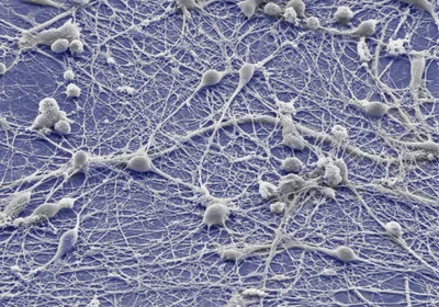 Microscope image of human induced pluripotent stem cell-derived neurons on graphene.