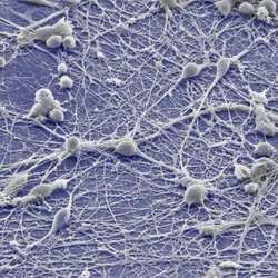 Microscope image of human induced pluripotent stem cell-derived neurons on graphene.