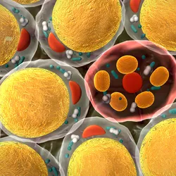 3D illustration of fat cells surrounding a transparent cell with a red membrane and growing fat stores in its center. This is a representation of breast tumor using nearby adipocytes as a source of energy to proliferate. 3D illustration of fat cells surrounding a transparent cell with a red membrane and growing fat stores in its center. This is a representation of breast tumor using nearby adipocytes as a source of energy to proliferate.