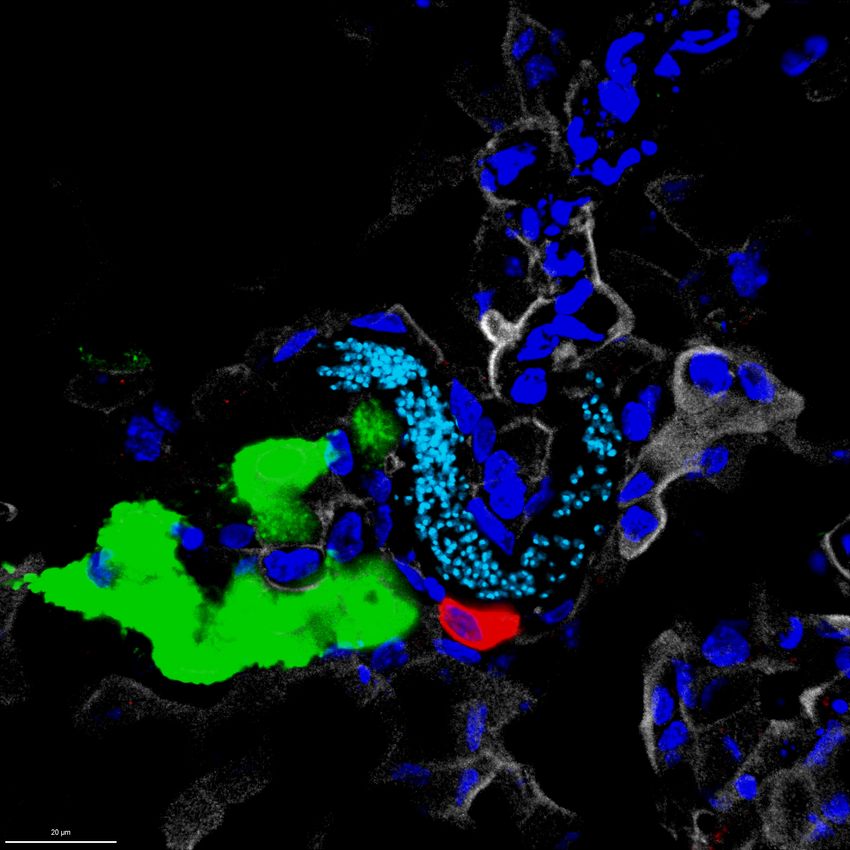 A whipworm is shown in an immunofluorescence and confocal image infecting gut epithelial cells in an organoid.