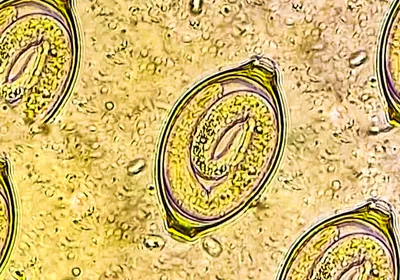  The human parasitic worm, Trichuris trichiura, is shown in its embryonic form in an egg, in this microscope image.