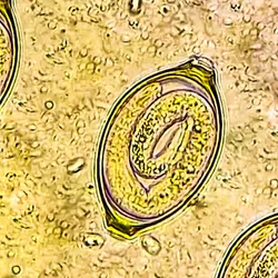 The human parasitic worm, Trichuris trichiura, is shown in its embryonic form in an egg, in this microscope image. The human parasitic worm, Trichuris trichiura, is shown in its embryonic form in an egg, in this microscope image.