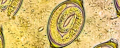 The human parasitic worm, Trichuris trichiura, is shown in its embryonic form in an egg, in this microscope image.