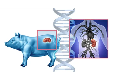 A blue pig with a red kidney is on the left-hand side of the image. A translucent human torso with black organs (except the left kidney, which is red). Red square outlines frame the kidneys, both in the pig and the human, indicating the interspecies organ transplant. A vertical, grey double-stranded DNA is at the center of the image, indicating the alpha-gal genetic modification in pigs, which has significantly improved xenotransplantation outcomes. 