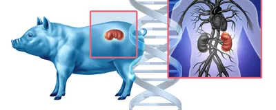 A blue pig with a red kidney is on the left-hand side of the image. A translucent human torso with black organs (except the left kidney, which is red). Red square outlines frame the kidneys, both in the pig and the human, indicating the interspecies organ transplant. A vertical, grey double-stranded DNA is at the center of the image, indicating the alpha-gal genetic modification in pigs, which has significantly improved xenotransplantation outcomes.