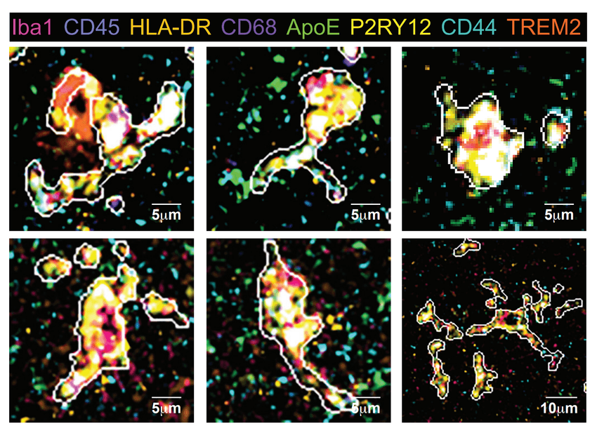 Six panels of microglia imaged with multiplexed ion beam imaging are shown. Different colors represent different protein levels.