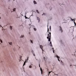 A microscope image of the brain’s immune cells called microglia are shown. A microscope image of the brain’s immune cells called microglia are shown.