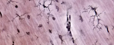 A microscope image of the brain’s immune cells called microglia are shown.