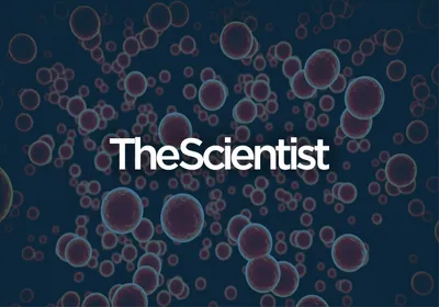 Unraveling Autophagy’s Complex Role in Cancer Unraveling Autophagy’s Complex Role in Cancer