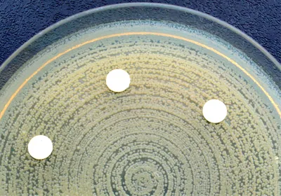 A petri dish with multidrug resistant bacterial colonies. A petri dish with multidrug resistant bacterial colonies.