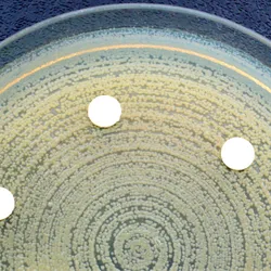 A petri dish with multidrug resistant bacterial colonies.