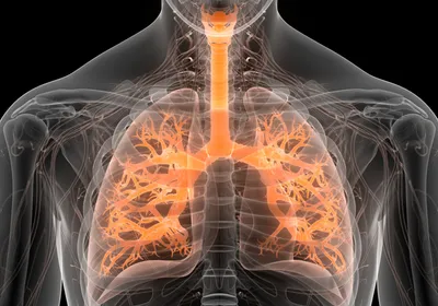 Illustration of a transparent human torso with the respiratory tract and alveoli highlighted in light orange to indicate asthma. 
