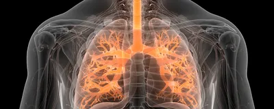 Illustration of a transparent human torso with the respiratory tract and alveoli highlighted in light orange to indicate asthma. 