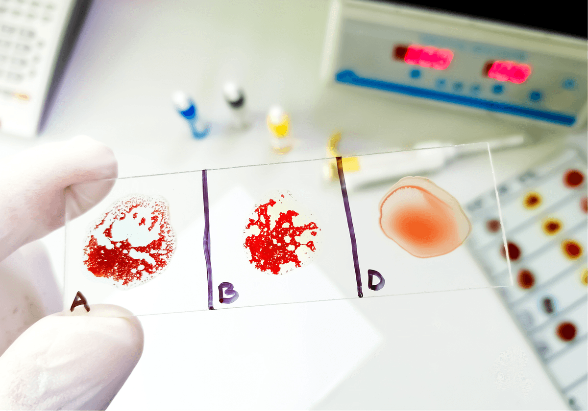 What Does a Rare Blood Type Mean? | The Scientist