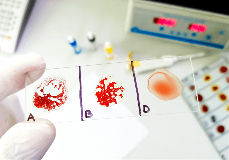 What Does a Rare Blood Type Mean?