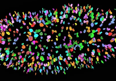 A mouse kidney at birth with the filtering units (nephrons) labelled in different colors by an AI software. A mouse kidney at birth with the filtering units (nephrons) labelled in different colors by an AI software.
